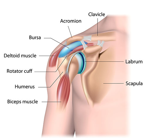 shoulder pain
